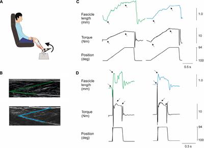 Increased Ankle Plantar Flexor Stiffness Is Associated With Reduced Mechanical Response to Stretch in Adults With CP